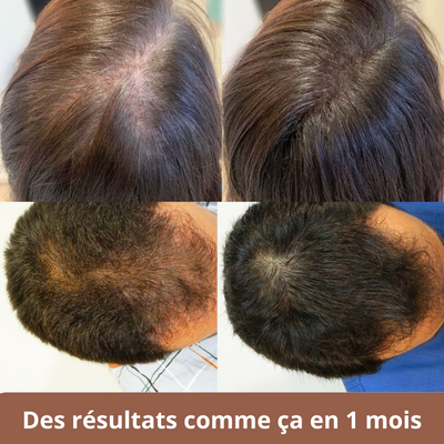 Shampoing solide au gingembre